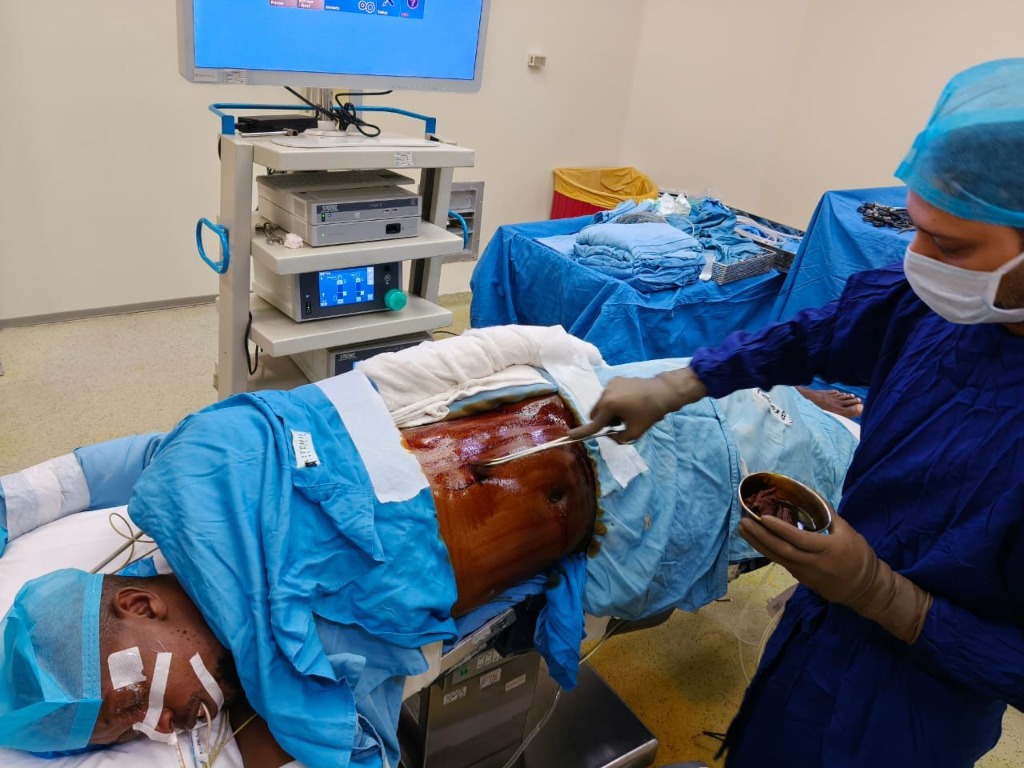 Surgical Field Preparation